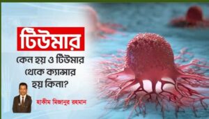 টিউমার কি? জেনে নিন টিউমার এর কারণ ও প্রতিকার
